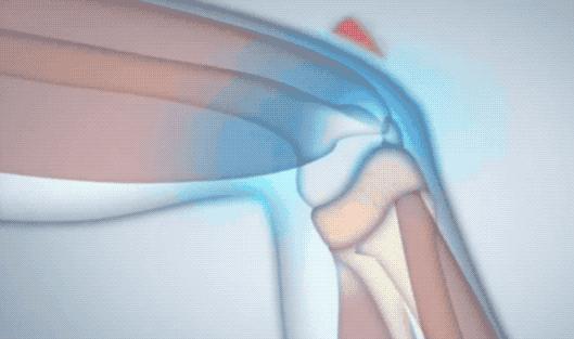 腰酸背痛、肩颈酸乏、肌肉疲劳？德国人有个家喻户晓的妙招||Chin@美物