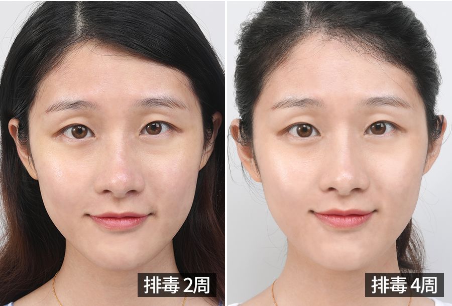 大长今金喜善宋慧乔,39岁宋慧乔完美复出御姐范十足