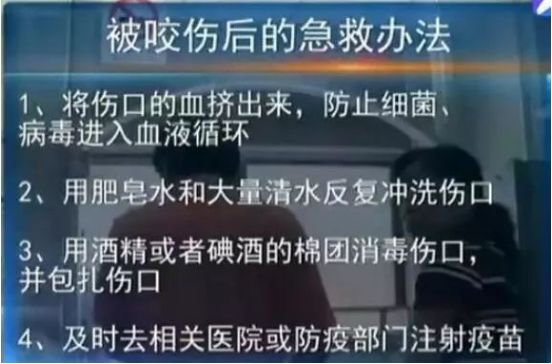 湖州狂犬病疫苗抗体检测,担心狂犬疫苗没有灭活