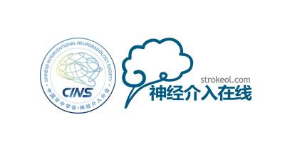 治疗颅内动脉瘤新型密网支架,pipeline治疗椎动脉夹层动脉瘤