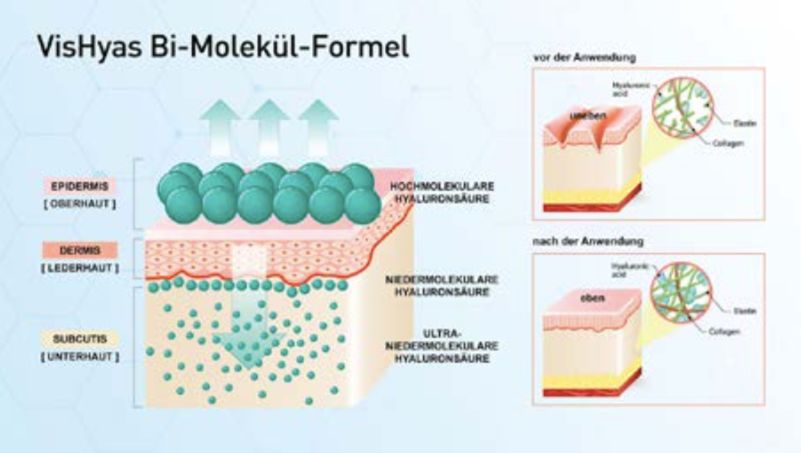薇诺娜玻尿酸乳液 (德国抗皱玻尿酸原液)