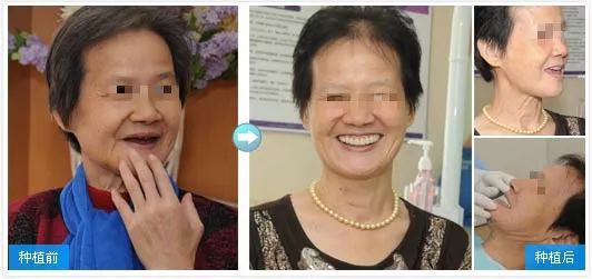 身份证36开头32结尾,身份证开头3756