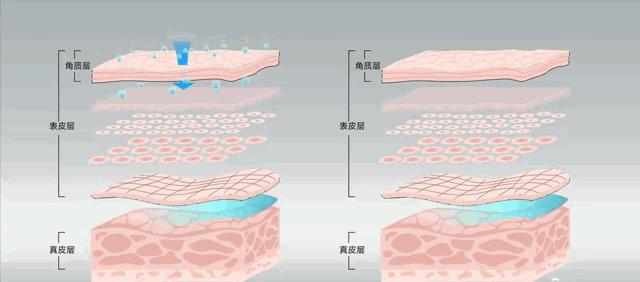 法令纹又黑又长,法令纹又深又长好吗