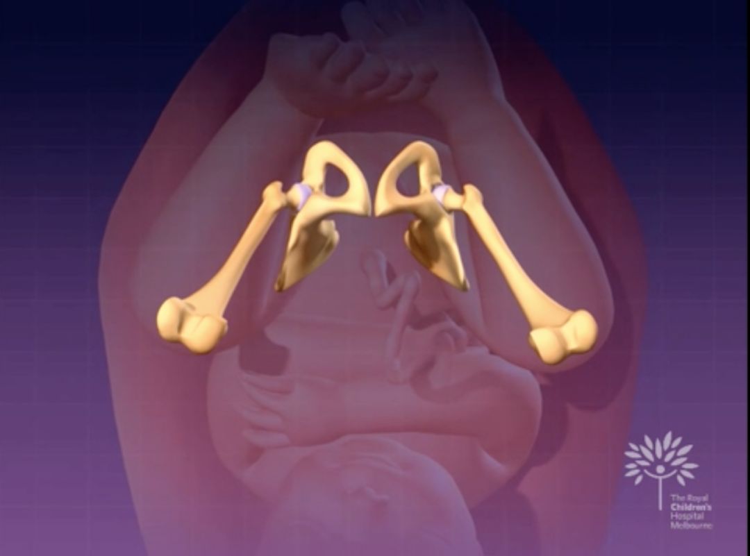 如何安全抱新生儿,宝宝裹襁褓睡会不会影响发育