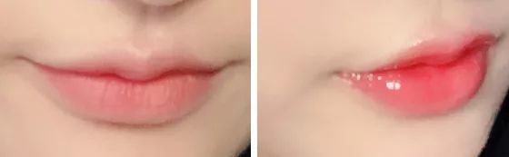 薄唇如何丰唇好看,丰唇使嘴唇变得更美