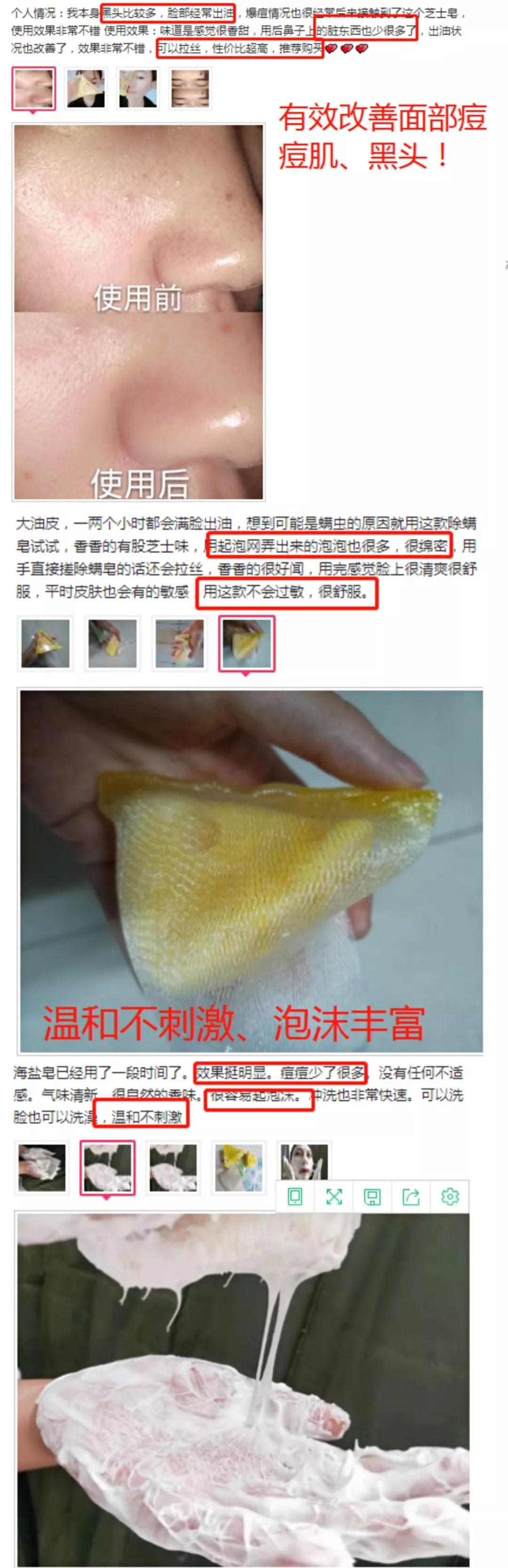 痘痘闭口里面有油脂,鼻子上的痘痘是青春痘还是粉刺