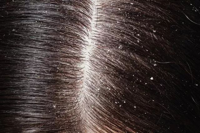 真正好用的洗发神器,一款超级好用的洗头神器