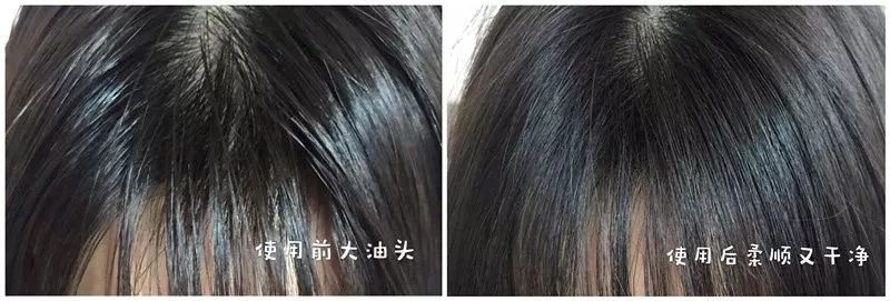 真正好用的洗发神器,一款超级好用的洗头神器