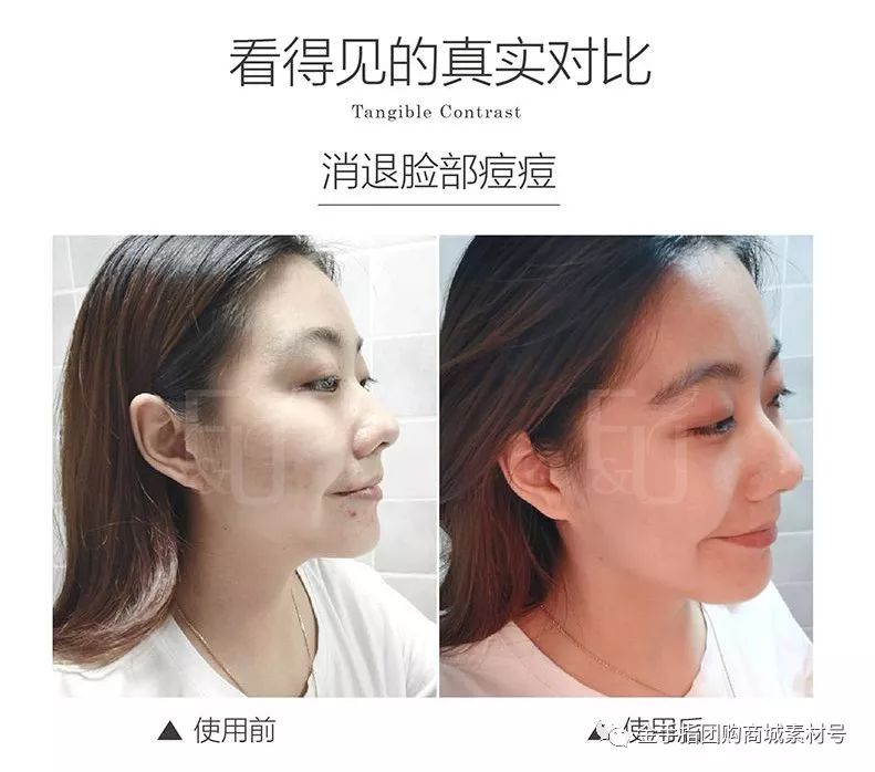 金手指团购券,金手指线上团购