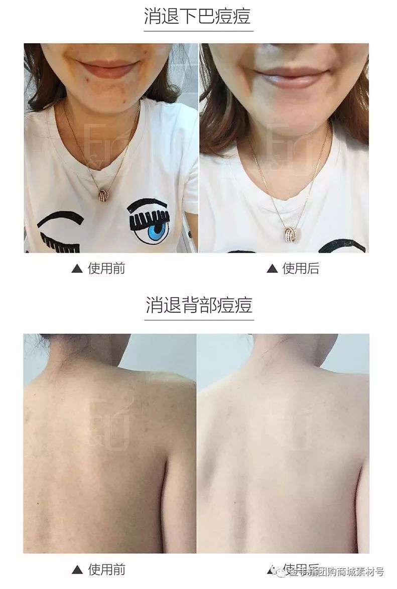 金手指团购券,金手指线上团购