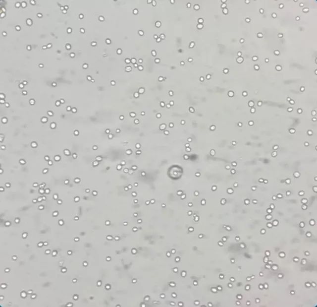 女儿大便里面有霉菌,孩子粪便里有霉菌