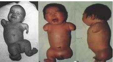 刚刚发现怀孕能不能吃药,早期怀孕吃药了能要吗