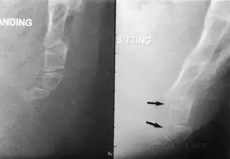 一文读懂十种腹痛,一文读懂骨关节炎