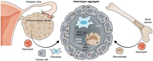 高庆蕾医学专家,高庆蕾卵巢癌生活方案