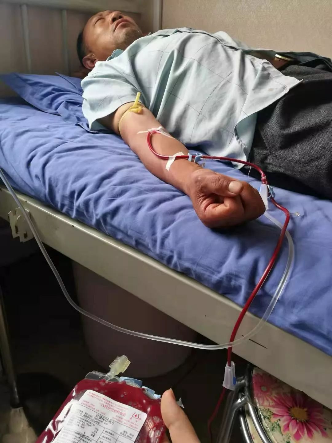 用自己的血治疗皮肤病,什么病要用三氧自体血疗法