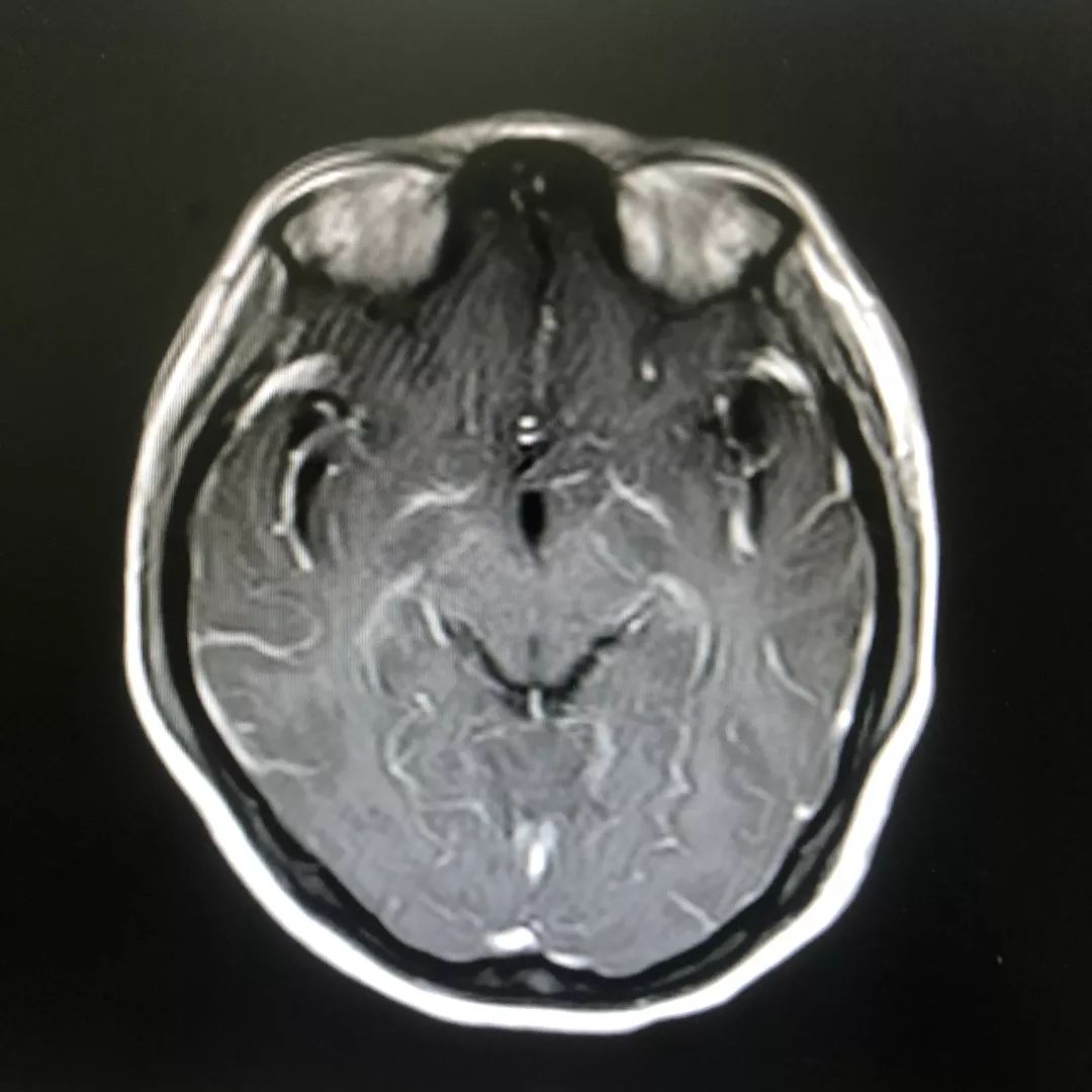 女子突然自言自语,女子疑似失常自言自语