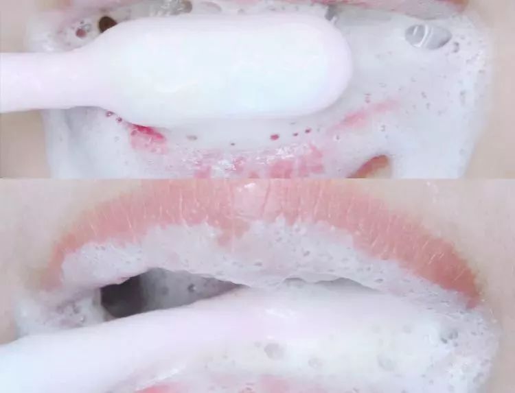 去除黄牙牙垢的牙膏,去口臭黄牙牙垢的牙膏