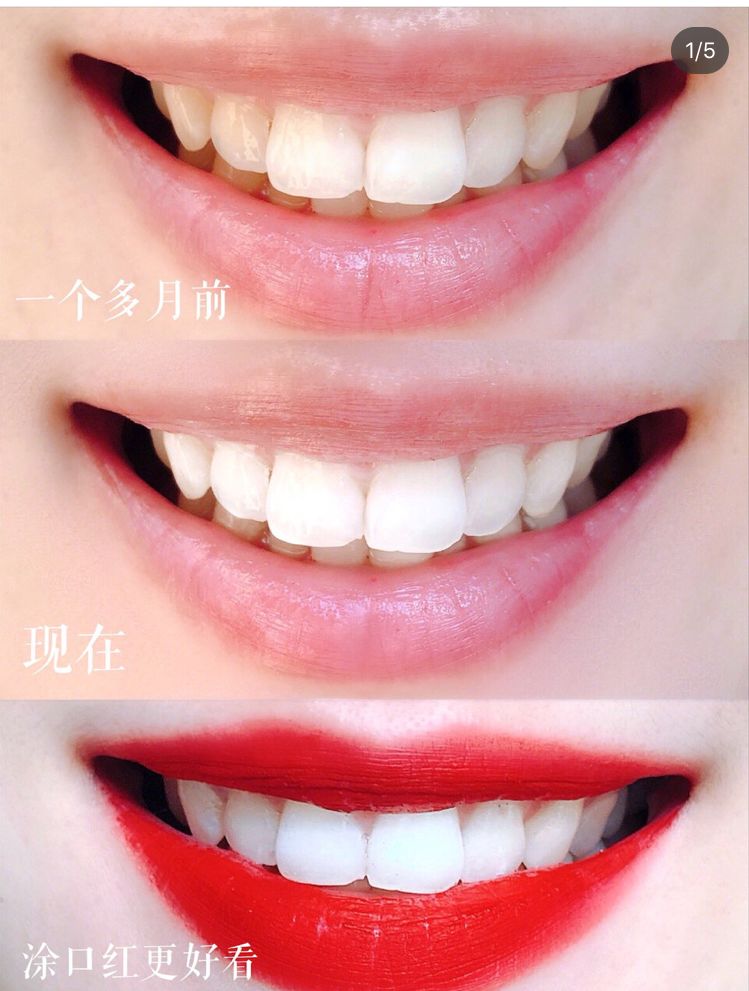 去除黄牙牙垢的牙膏,去口臭黄牙牙垢的牙膏