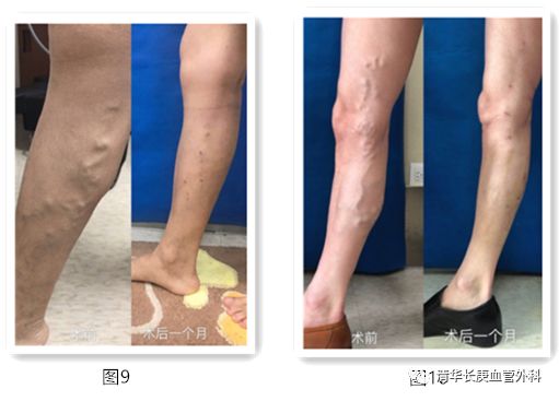 认识静电现象教案,认识静电教案