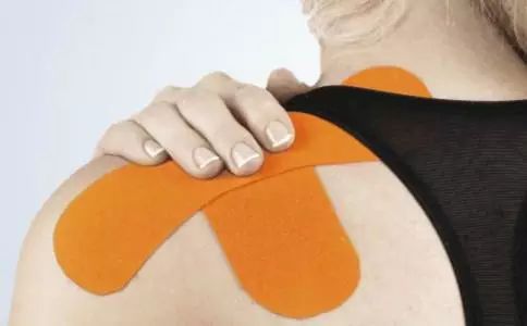 肩关节脱位的日常康复指导有哪些,肩关节脱位保守治疗怎样康复训练