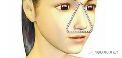 画面极度舒适！十几年顽固老黑头，30秒彻底连根拔起！毛孔畅快呼吸原来是这种感觉