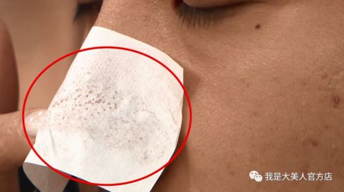 画面极度舒适！十几年顽固老黑头，30秒彻底连根拔起！毛孔畅快呼吸原来是这种感觉