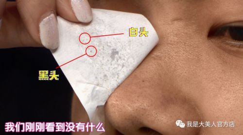 画面极度舒适！十几年顽固老黑头，30秒彻底连根拔起！毛孔畅快呼吸原来是这种感觉