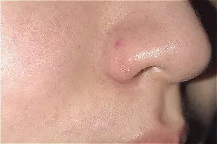 冬季干燥持久补水喷雾300ml保湿,补水喷雾巨补水秋冬