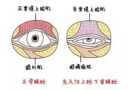 这些表现巨伤娃的眼！你却不知道？