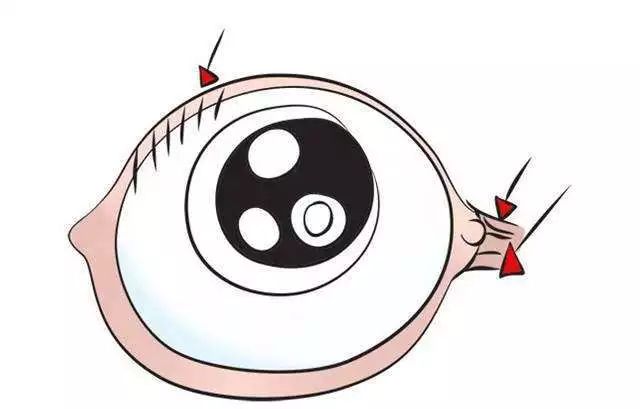 这些表现巨伤娃的眼！你却不知道？