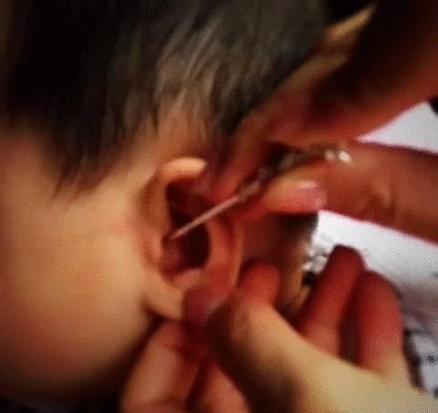 糠耳怎么会变成油耳,为什么有些人是油耳有些人是干耳