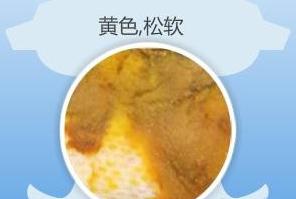 宝宝大便量怎么判断少,宝宝便便知多少ppt