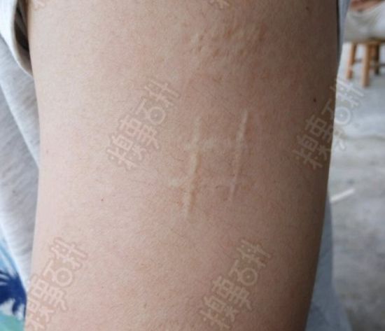 这个是啥？我父母、爷爷都有，为啥我没有？