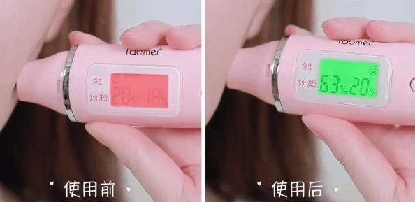 挤痘痘出来的白色长条状是什么,痘痘黑头挤出白颗粒