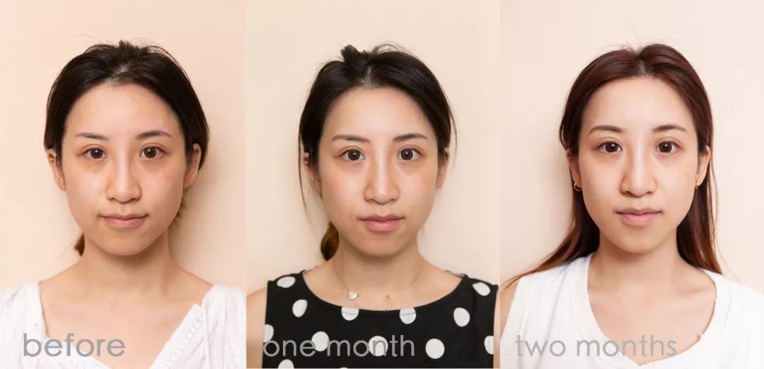 肌诊室·特别版|真人体验，医美素颜光vs明星微精华，改善皮肤哪家强？