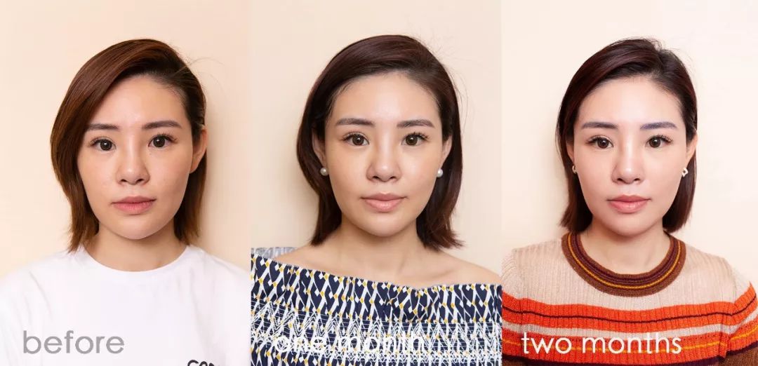 肌诊室修复,肌诊室水光肌挑战