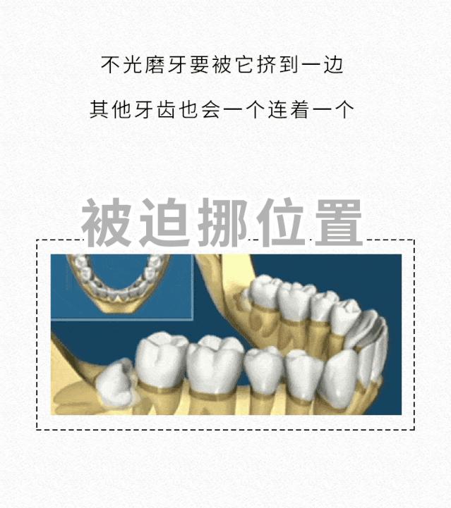 拔智齿的全过程漫画,智齿漫画版