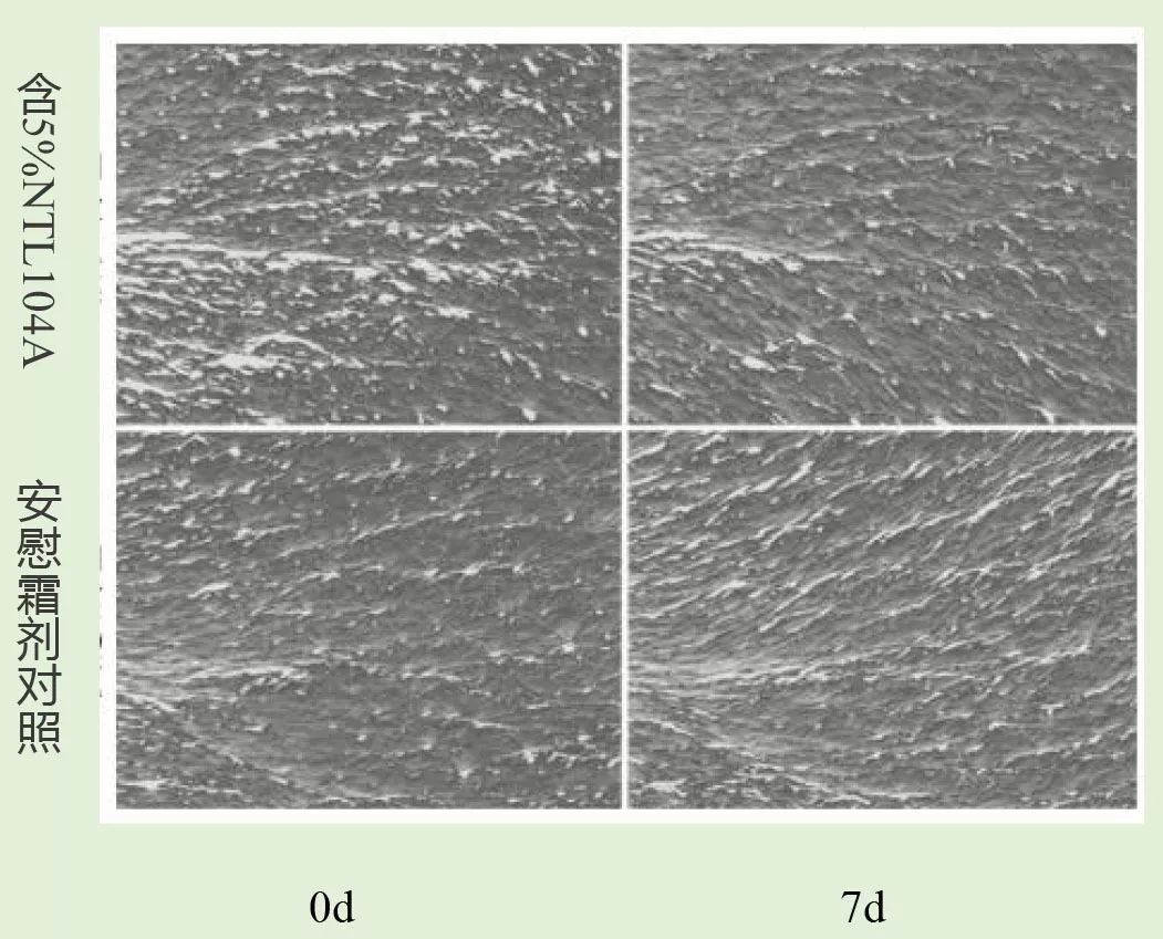 法令纹眼纹一个都逃不掉,法令纹和眼纹怎么才能有效改善