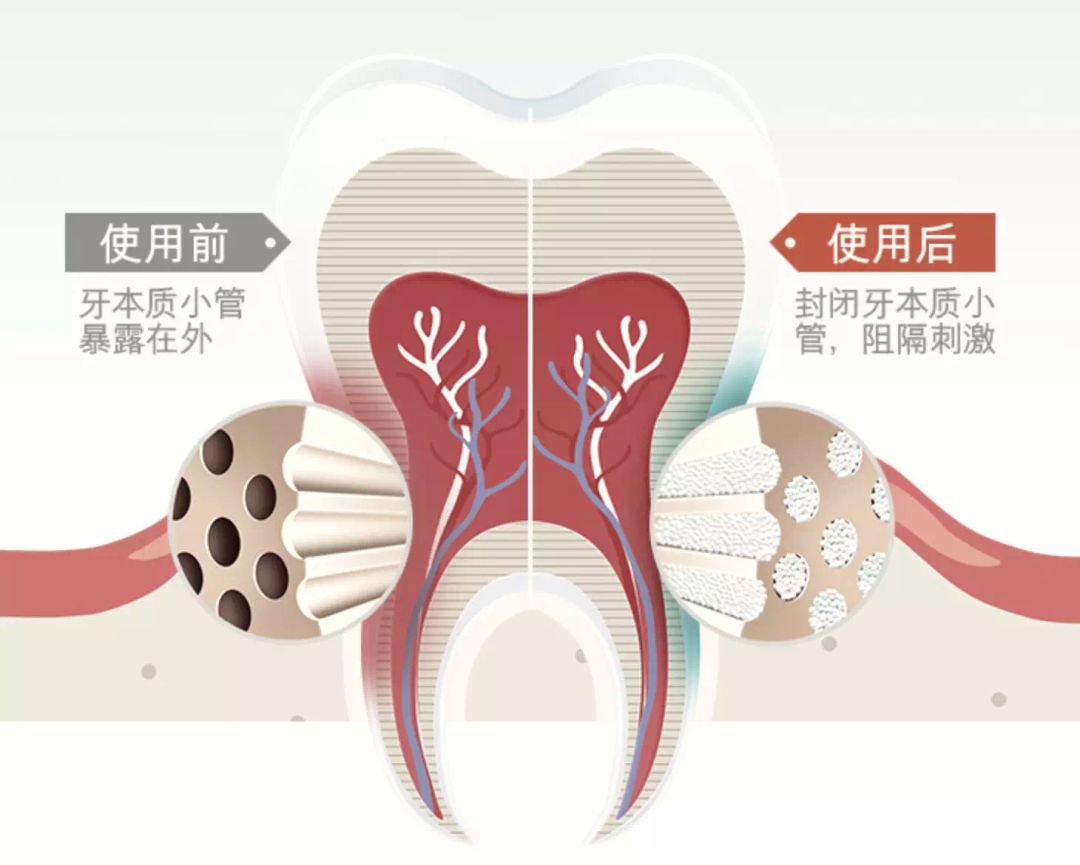 谢谢这支瑞士大牌牙膏，让我痛快吃火锅喝奶茶