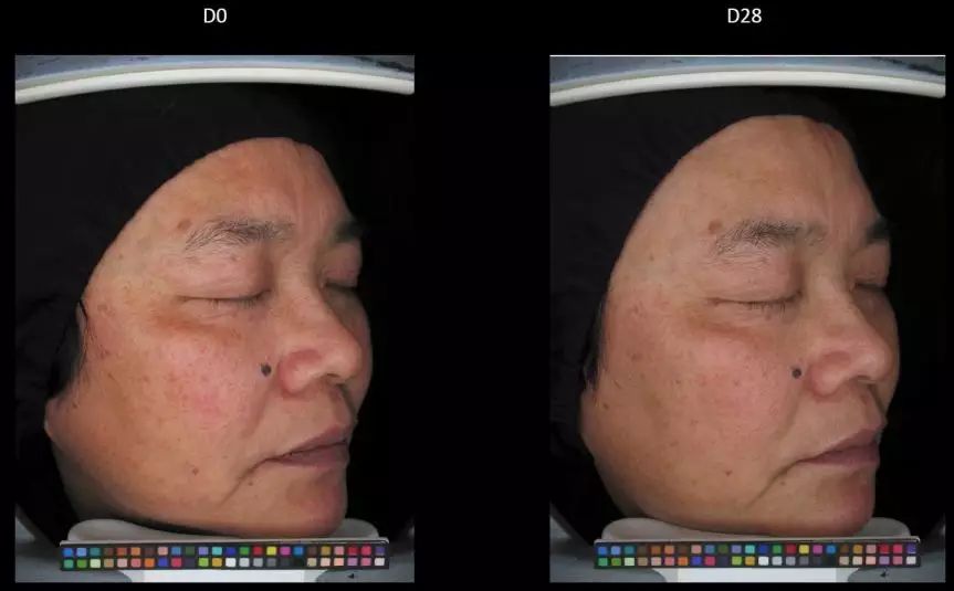 科学合理变白教程,变白最全攻略