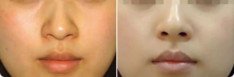 1元体验“爱马仕”级的变美服务，限量100份，再不抢就没了