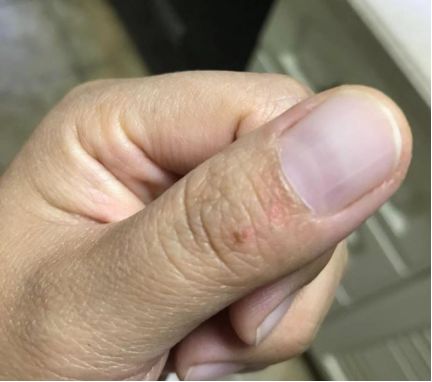 做饭的时候燃气灶炸开怎么回事,做饭时候灶台玻璃炸裂怎么办