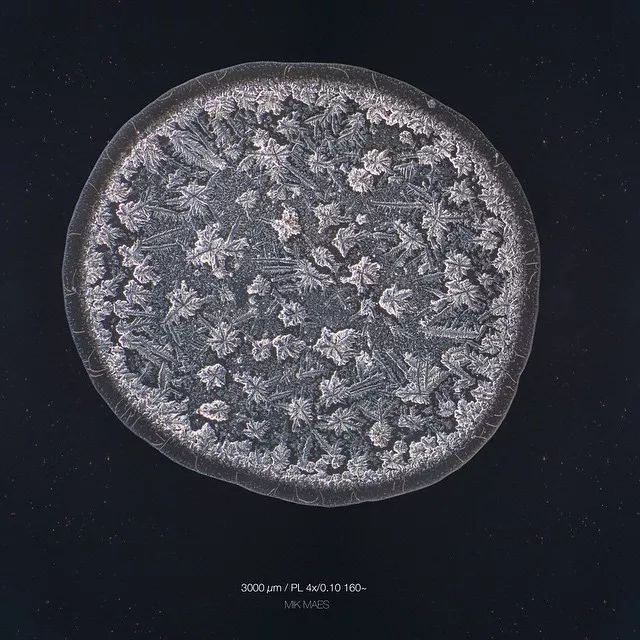 显微镜下的各种眼泪,显微镜下的眼泪原版