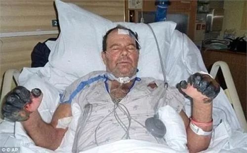 灭鼠宣传手册,鼠疫防控手册