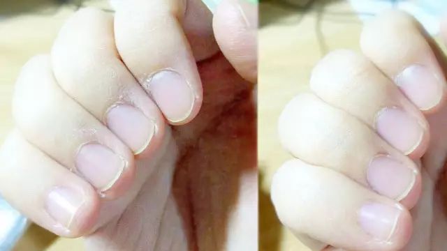 不要让你暴露你的年龄,别让皮肤暴露了你的年龄