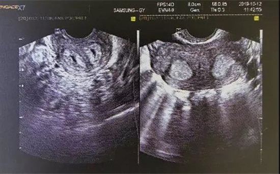 雅安恒博妇产医院技术好吗,雅安市恒博医院妇产科好不好