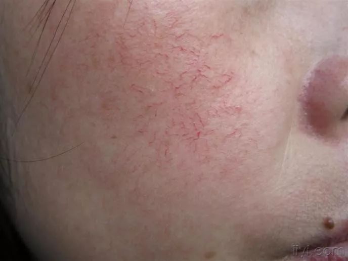 洗脸仪会对皮肤有伤害吗,洗脸仪真的假的