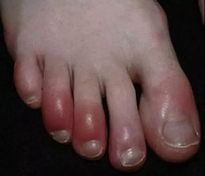 日本人吃饭都不穿鞋，熏死人了！这双耗时3年的黑科技银离子袜，美白润肤自发热，穿7天都不臭脚