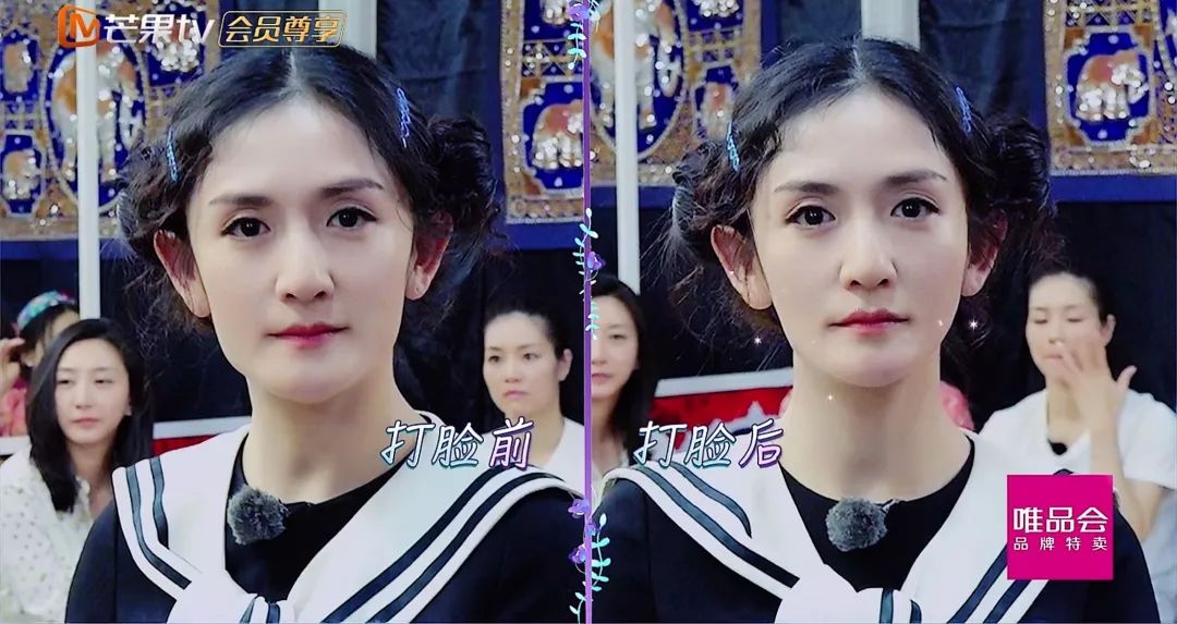 泰国打脸法瘦脸,泰国打脸术真的能瘦脸