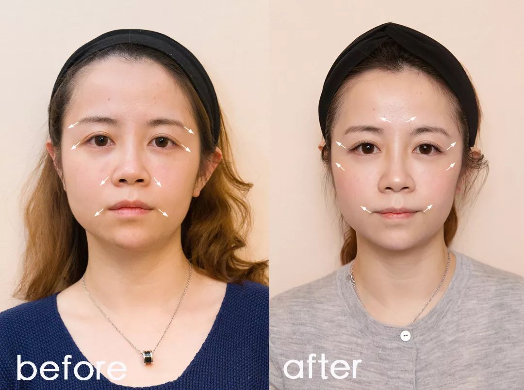 抗老三部曲紧致少女肌,抗老做好这五步hold住童颜少女肌